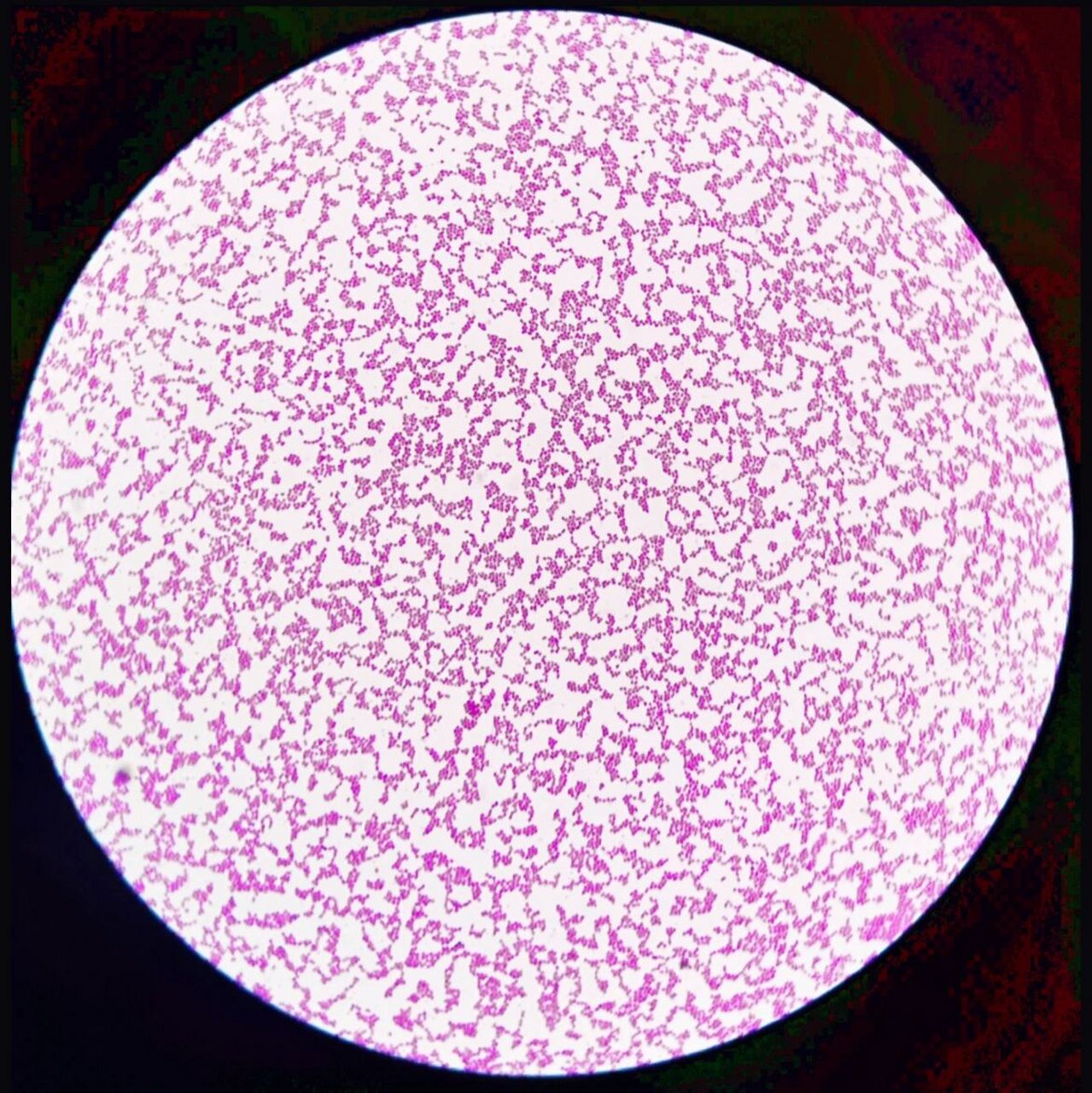 粪肠球菌(含镜检) 形态与染色:肠球菌为革兰阳性球菌,菌体直径为0.