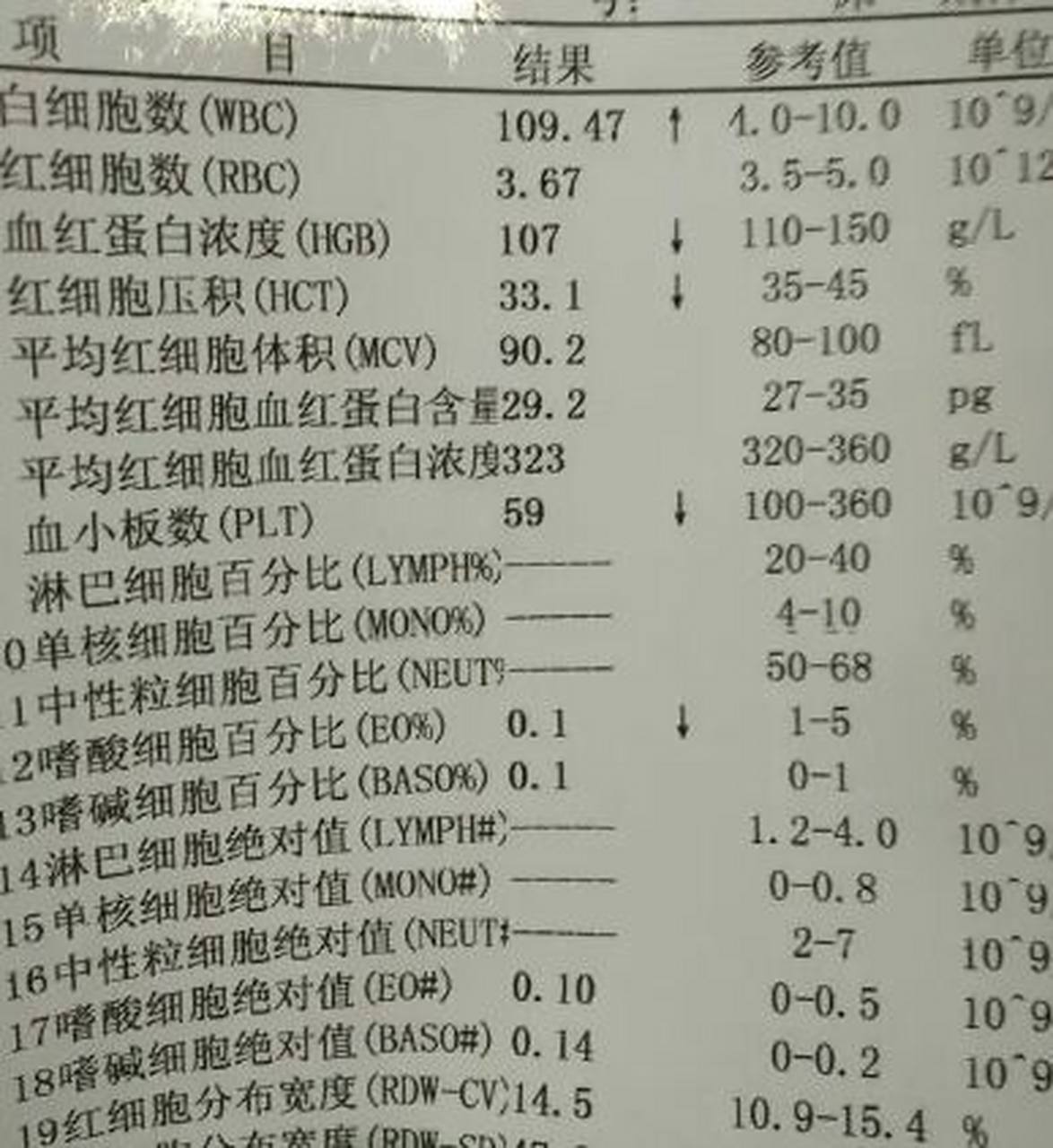 具体如下: 	 1,如果白细胞高,同时是中性粒细胞升高,往往提示有细菌