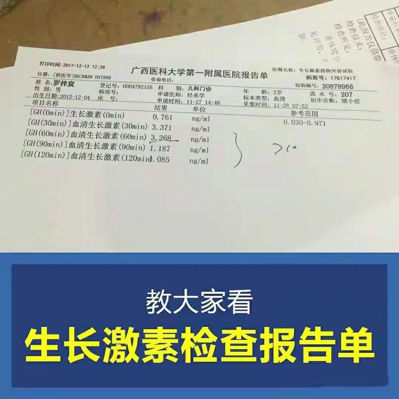 生长激素激发试验结果图片