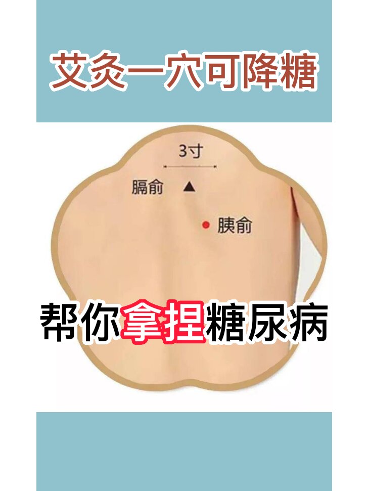 艾灸一穴降血糖,帮你拿捏糖尿病 艾灸一穴可降糖?