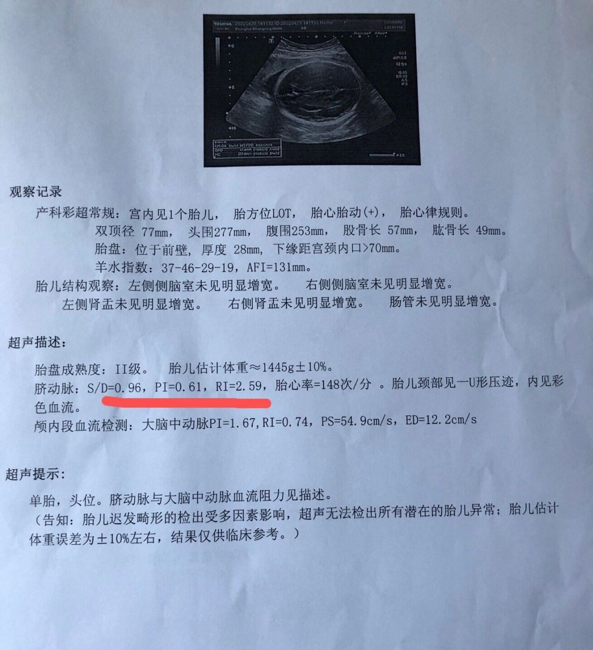 59,和身边的2,3个孕妇姐妹对比过,总感觉这个值偏低,医生说没问题