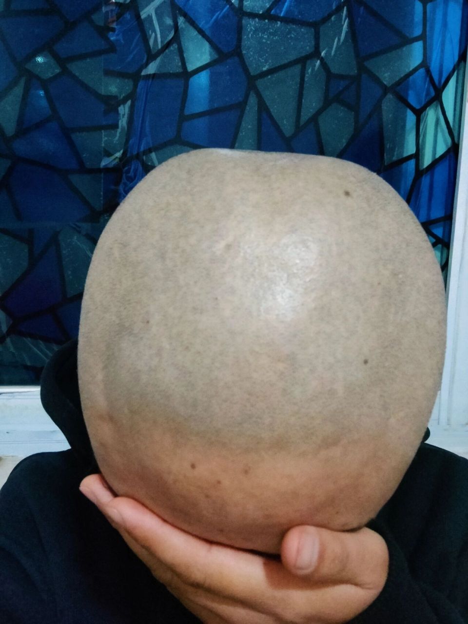 左滑看光头三个月能长多长  距离最后一次剃光头马上就三个月啦,中间