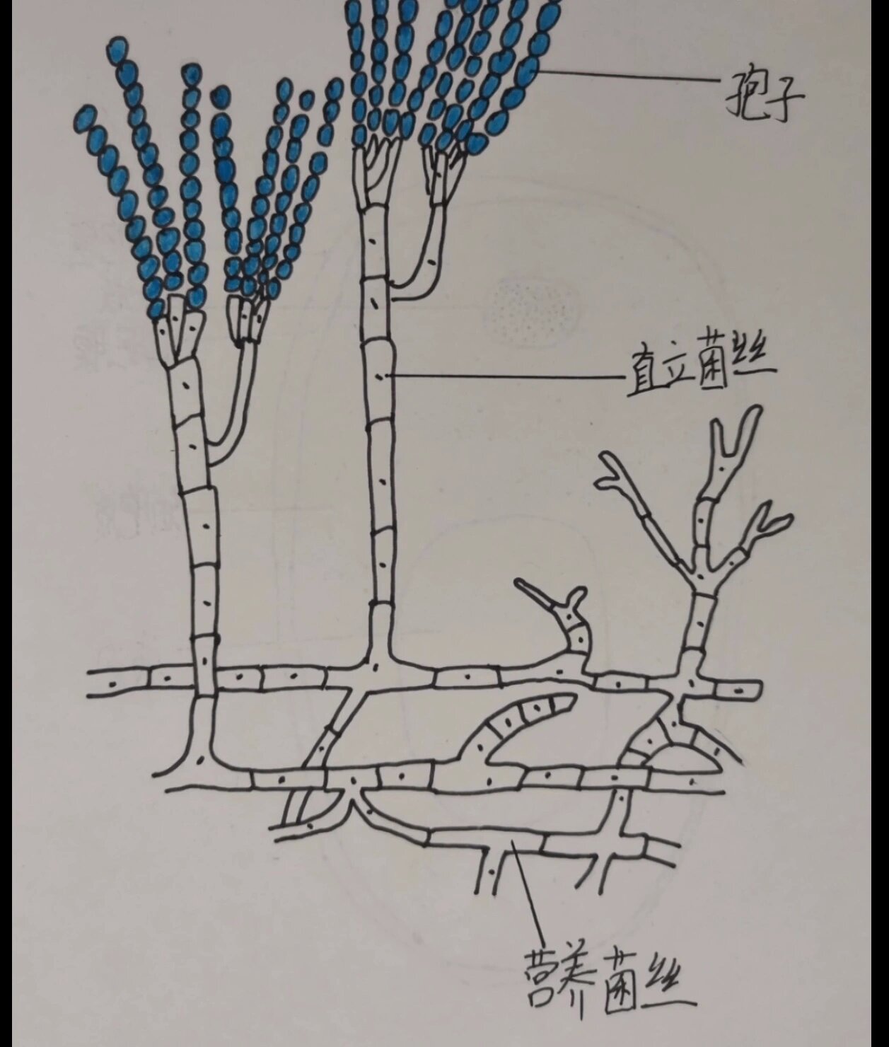 结核分枝杆菌手绘图片图片