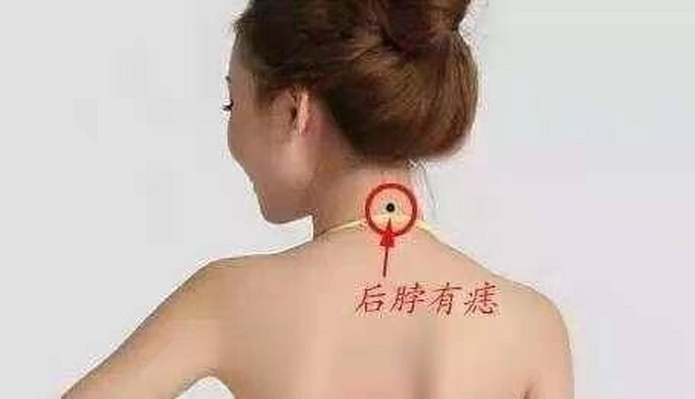 7315女人后背长痣:脊柱正中有痣 7315如果一个女人的后背