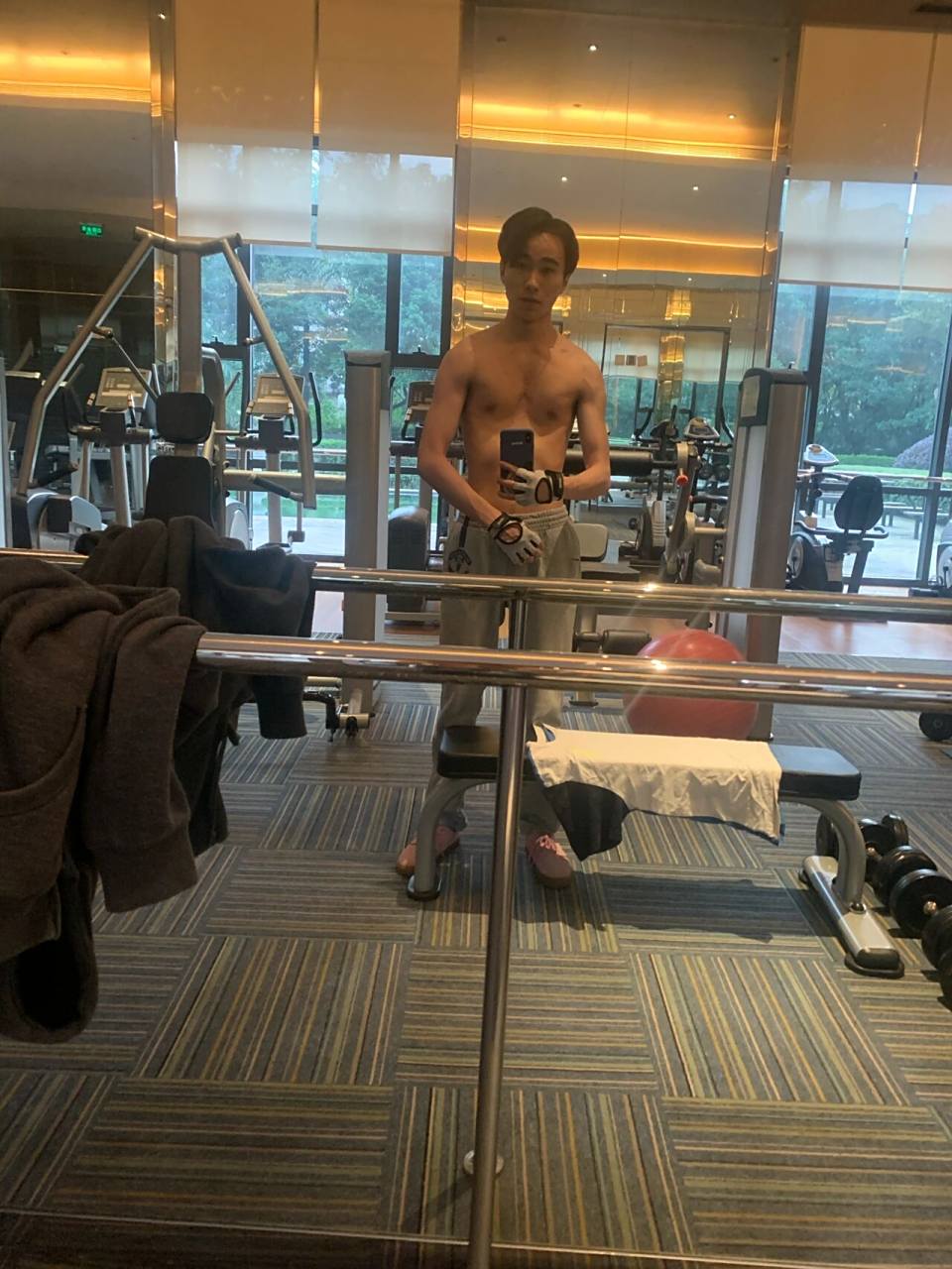 曾漏斗胸让我自卑,没做手术现在几乎看不出 小伙伴们其实不用太担心