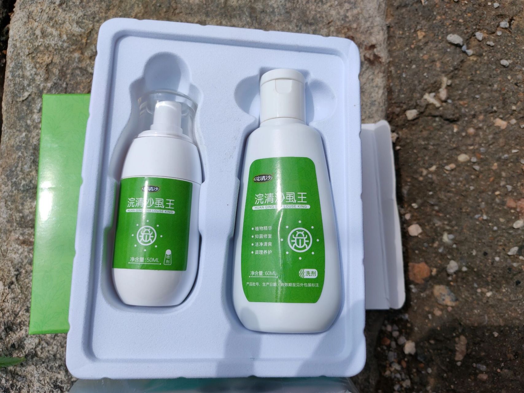 孩子被传染头虱一定要注意了 头虱属于传染病,孩子会