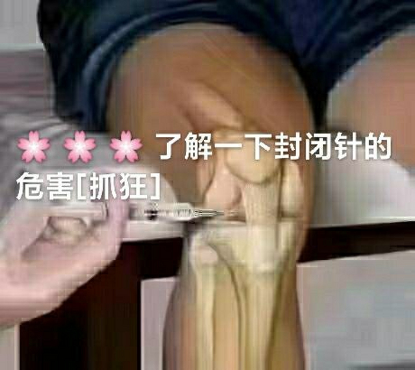 打封闭针的危害您了解多少 封闭针是用大量激素和润滑液注射到患处,以