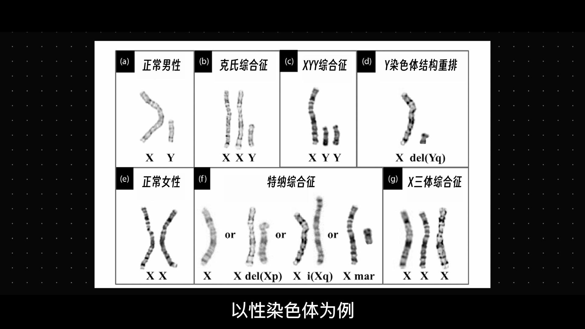 XXY染色体人的特征图片