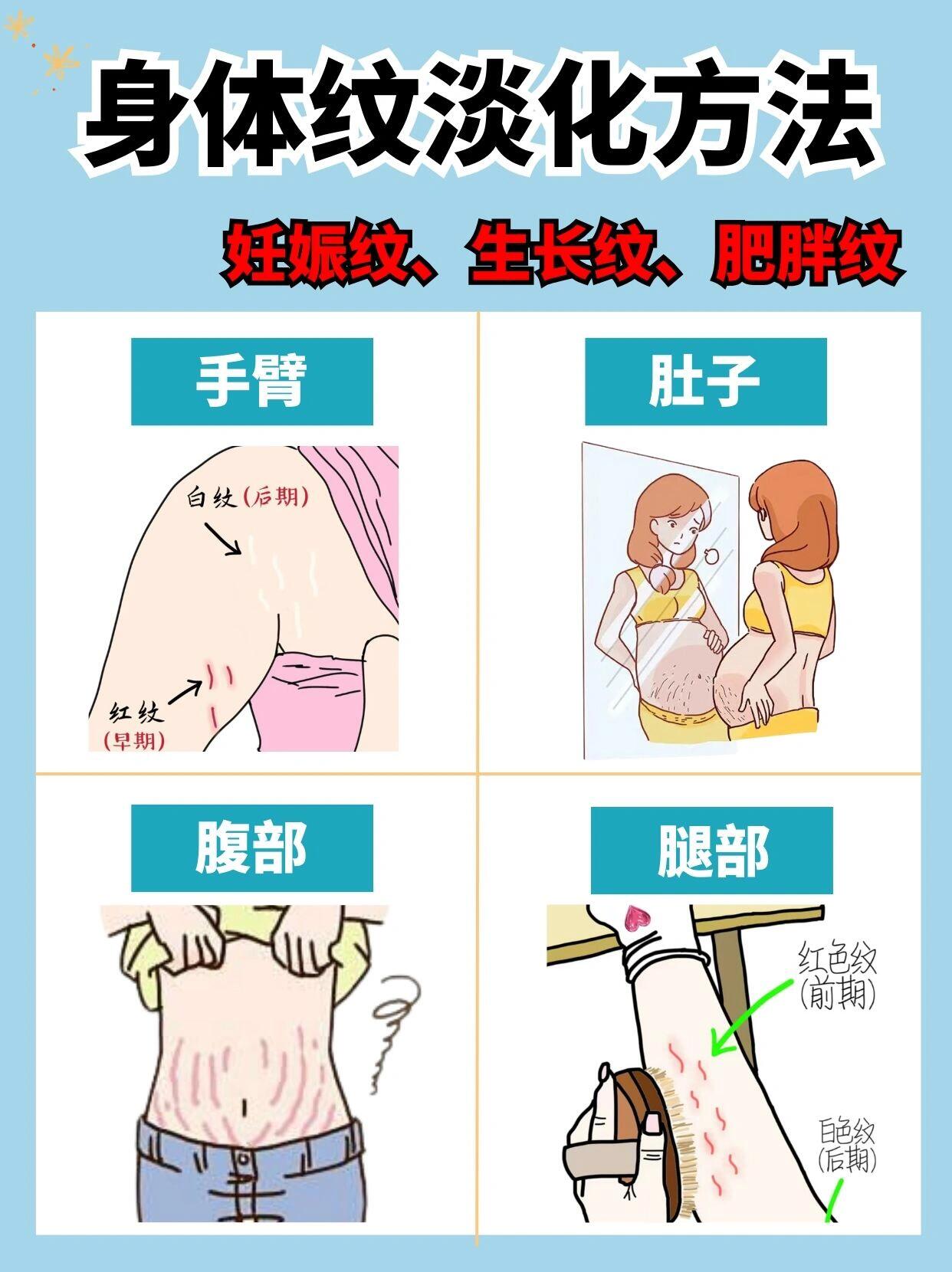 不删6015妊娠纹,肥胖纹,生长纹的淡化攻略 94纹路类型对照 1.