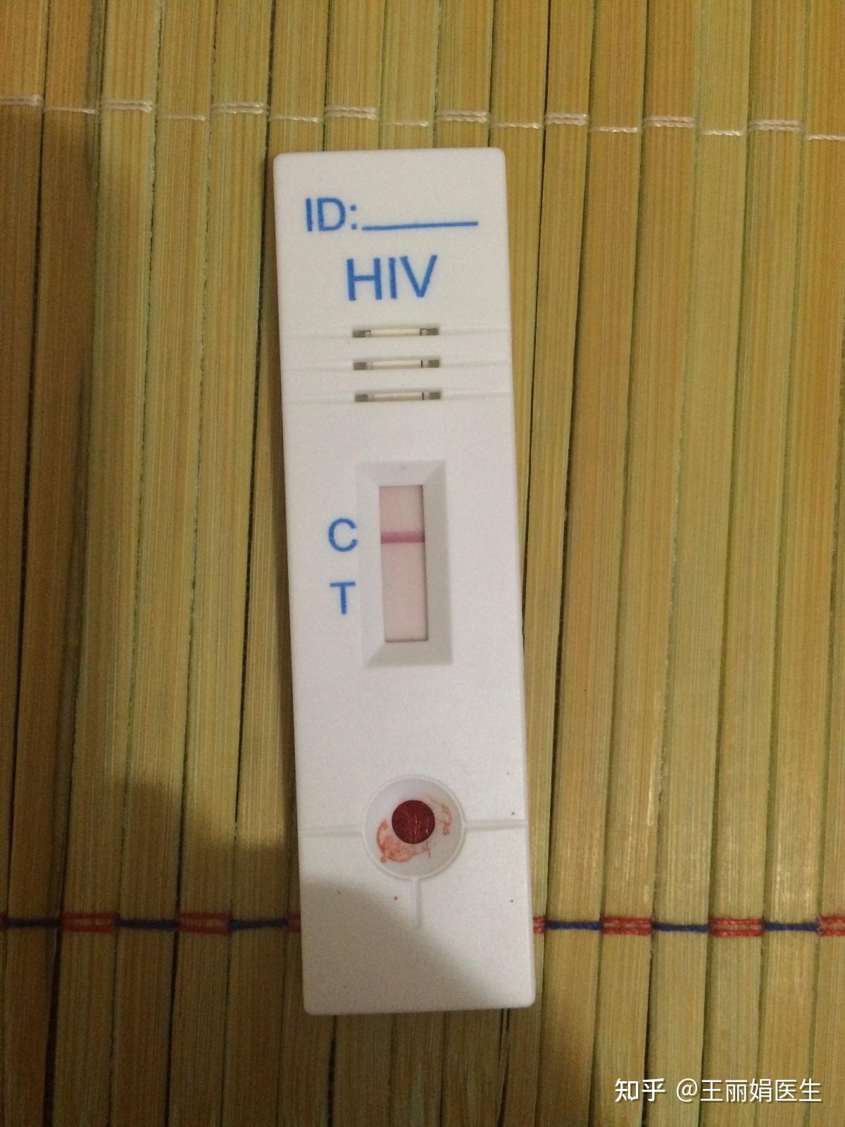 hiv弱阳图片