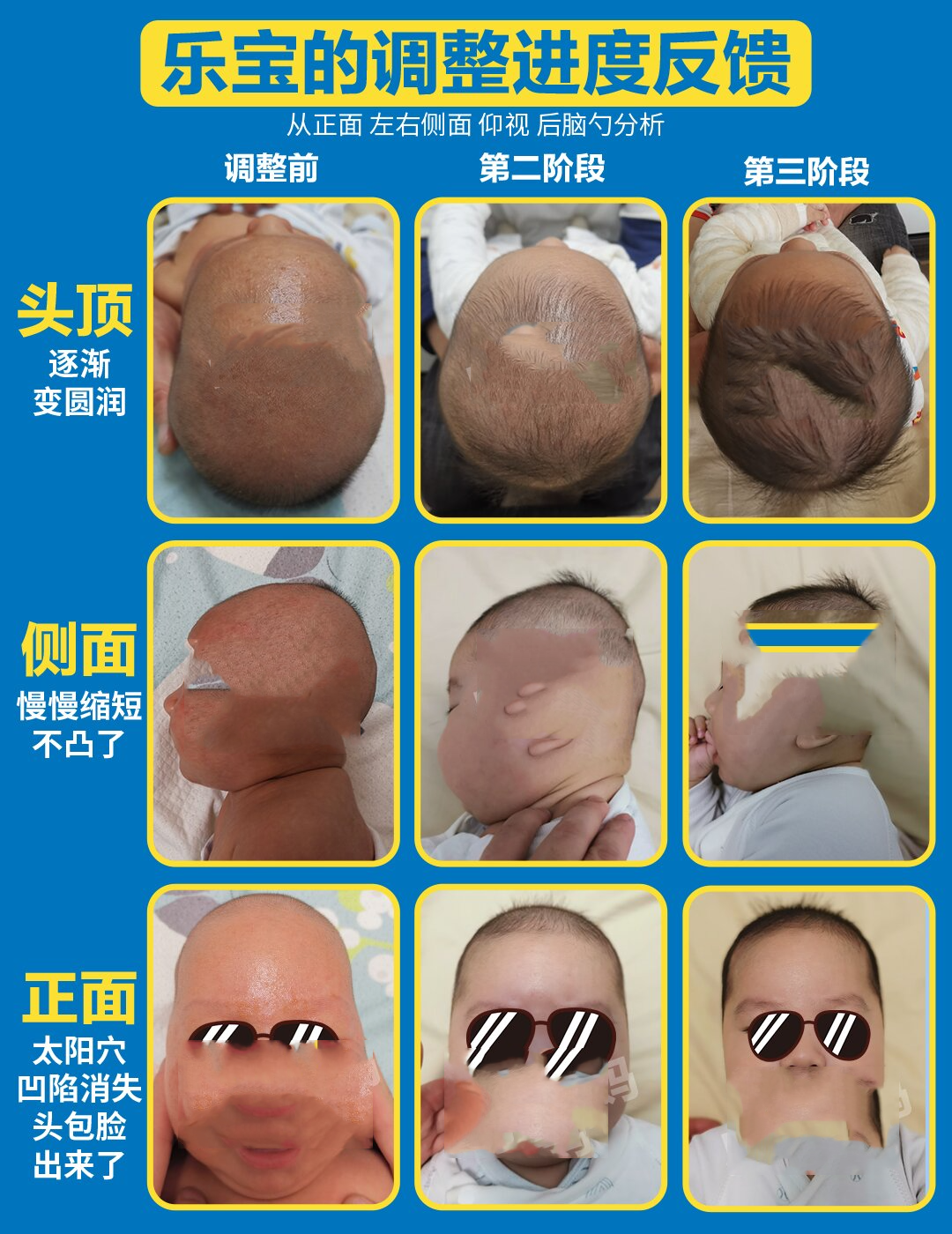 非常漂亮的圆头,并且已睡出头包脸,太阳穴饱满,同时上扁消失,后脑勺