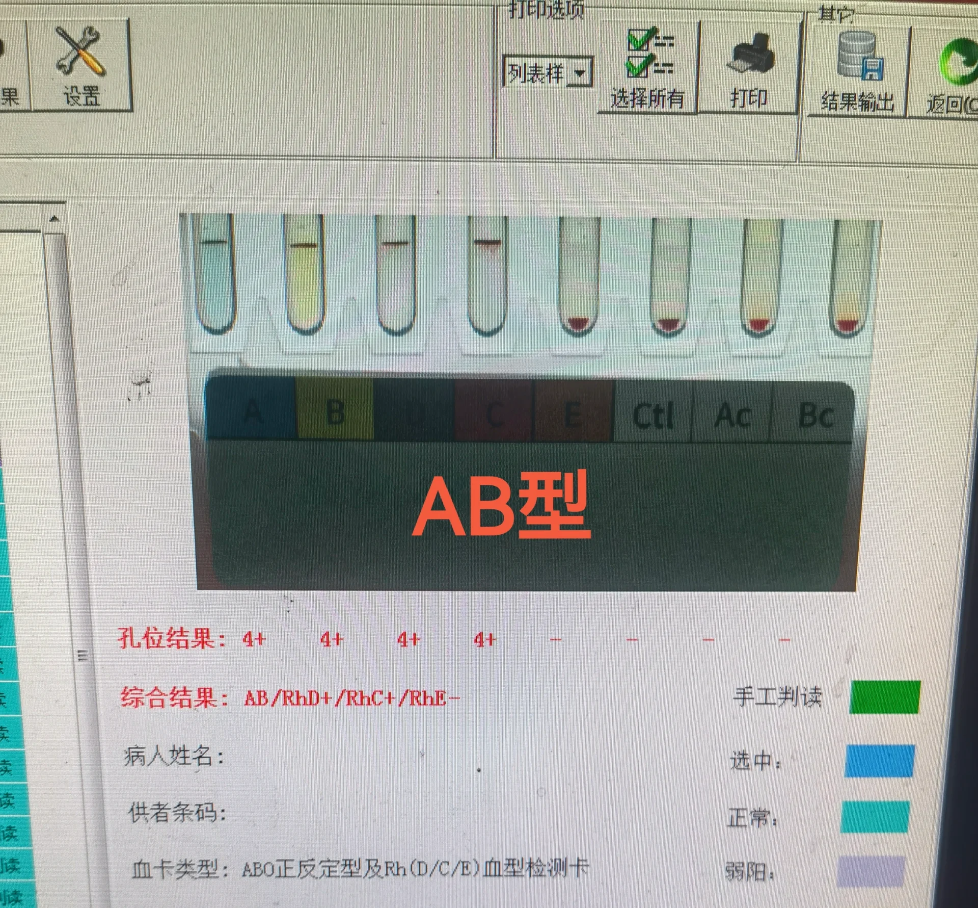 微柱凝胶法图片