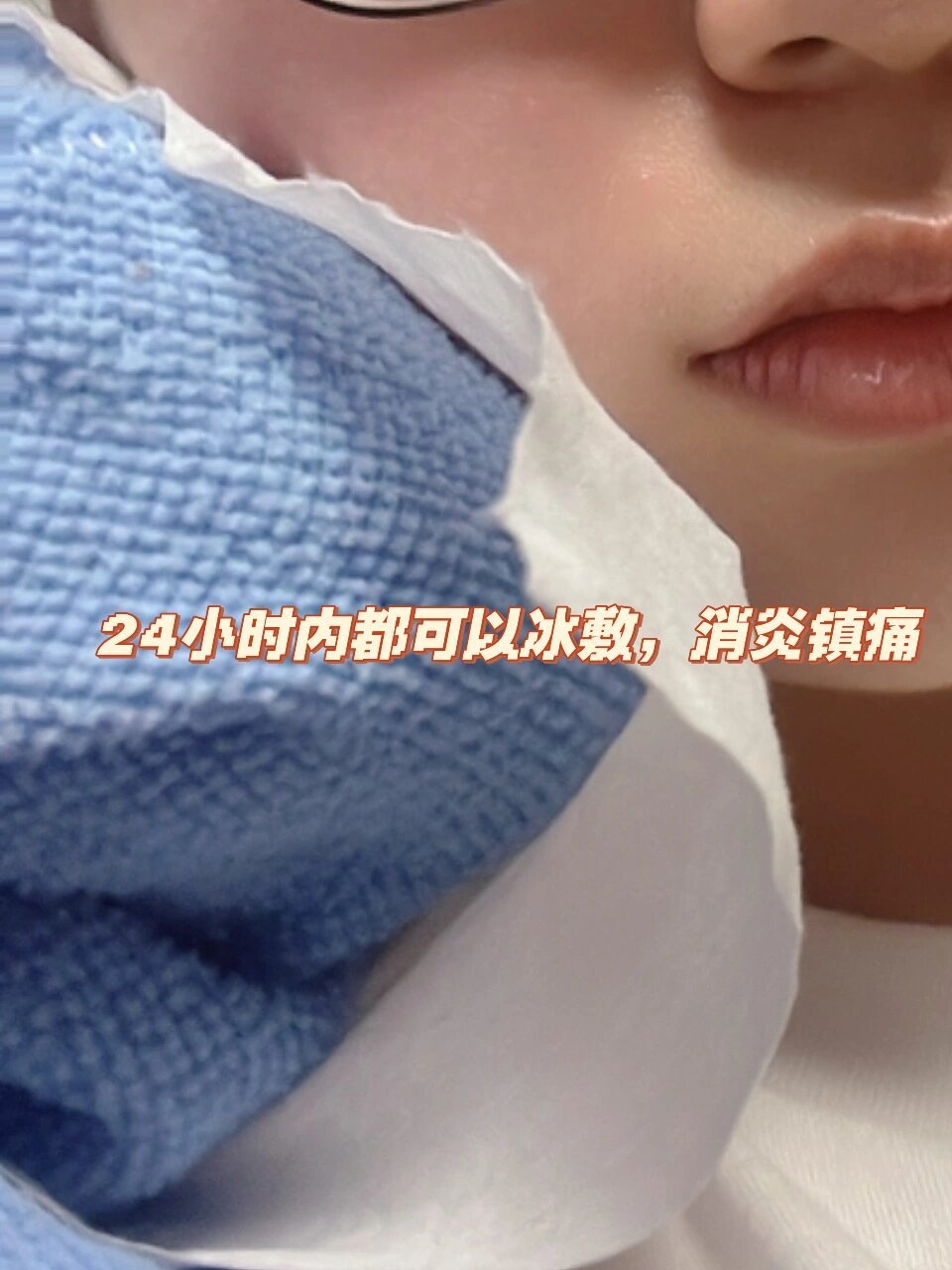 尽量上午去拔牙!拔完棉球咬30-60分钟 2.