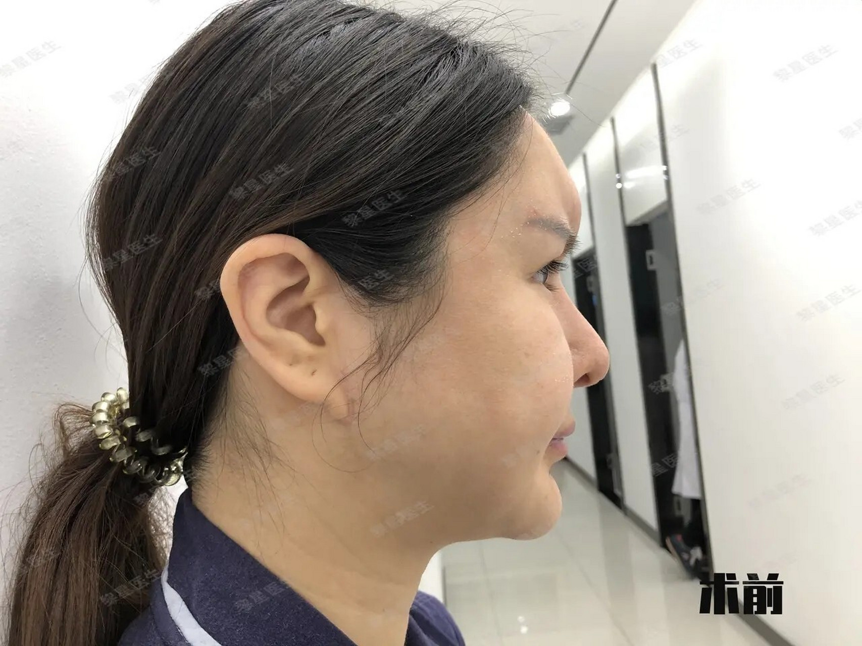 生长因子增生疯长,长得到底是什么?