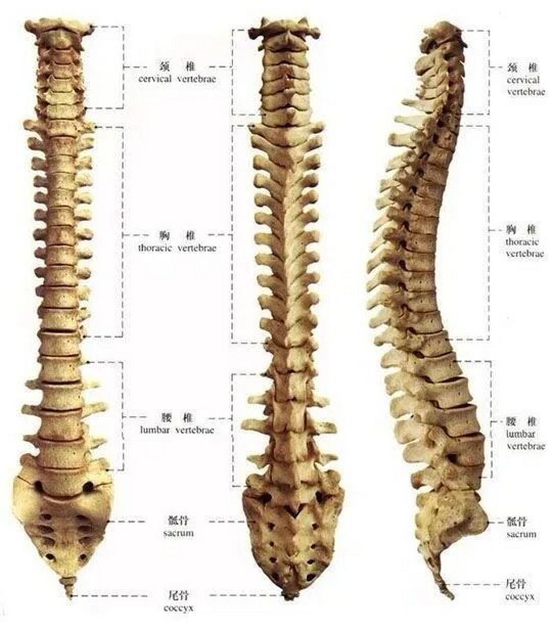 【煩死了 腰突 許莫式結節】 也不知道一個腰椎竟然能有那麼多的毛病