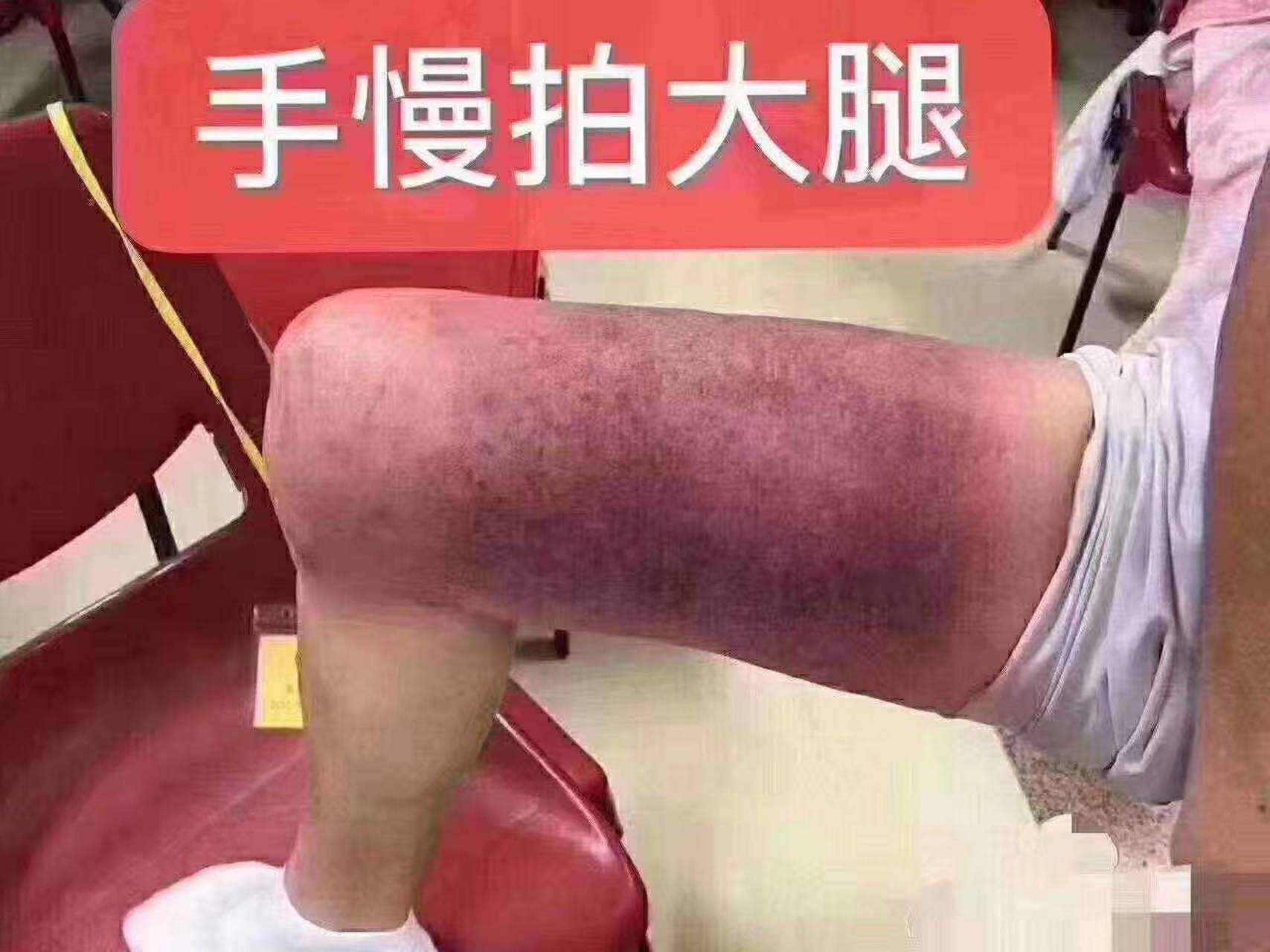 大腿拍紫表情图图片