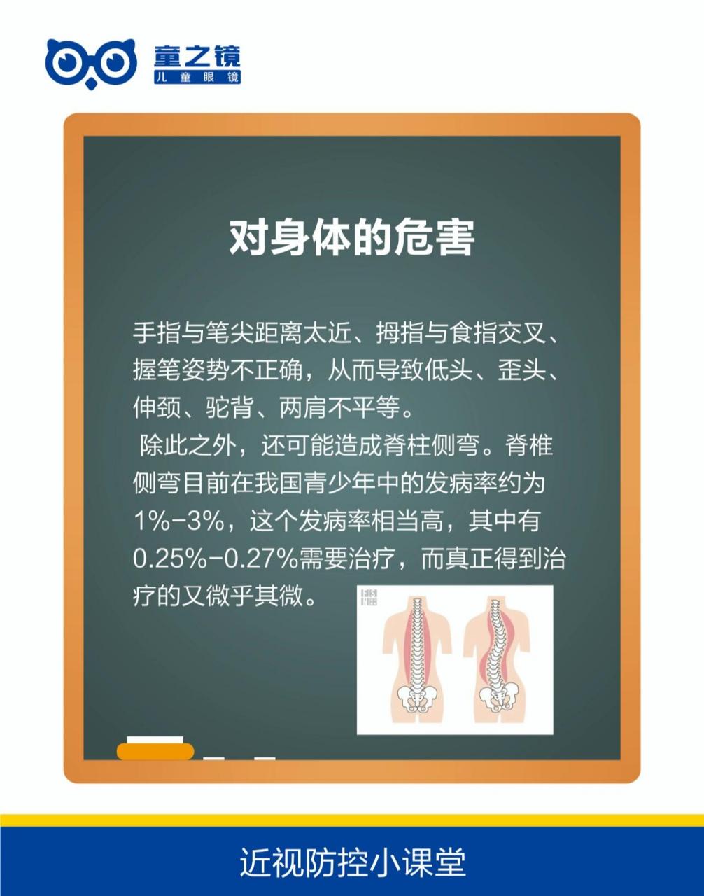 握笔姿势不正确带来的危害 一错误74的握笔姿势,能像蝴蝶效应一样