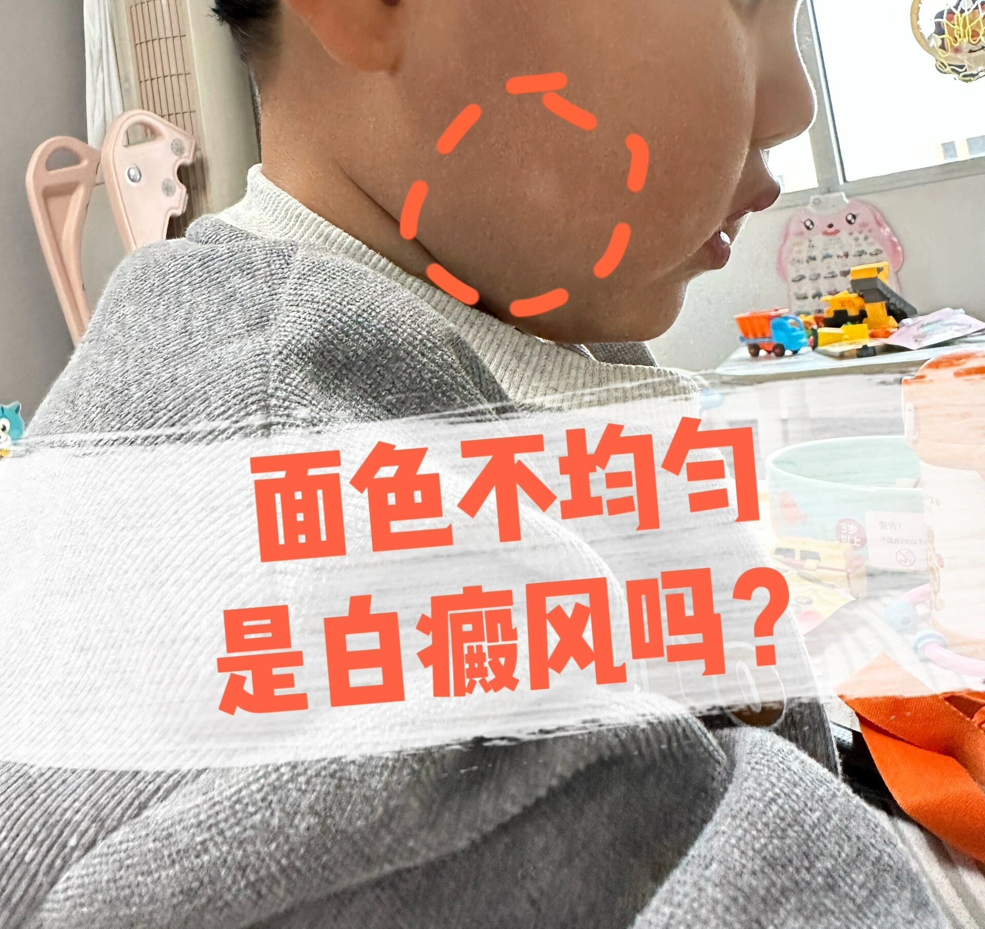 宝宝面色不均匀