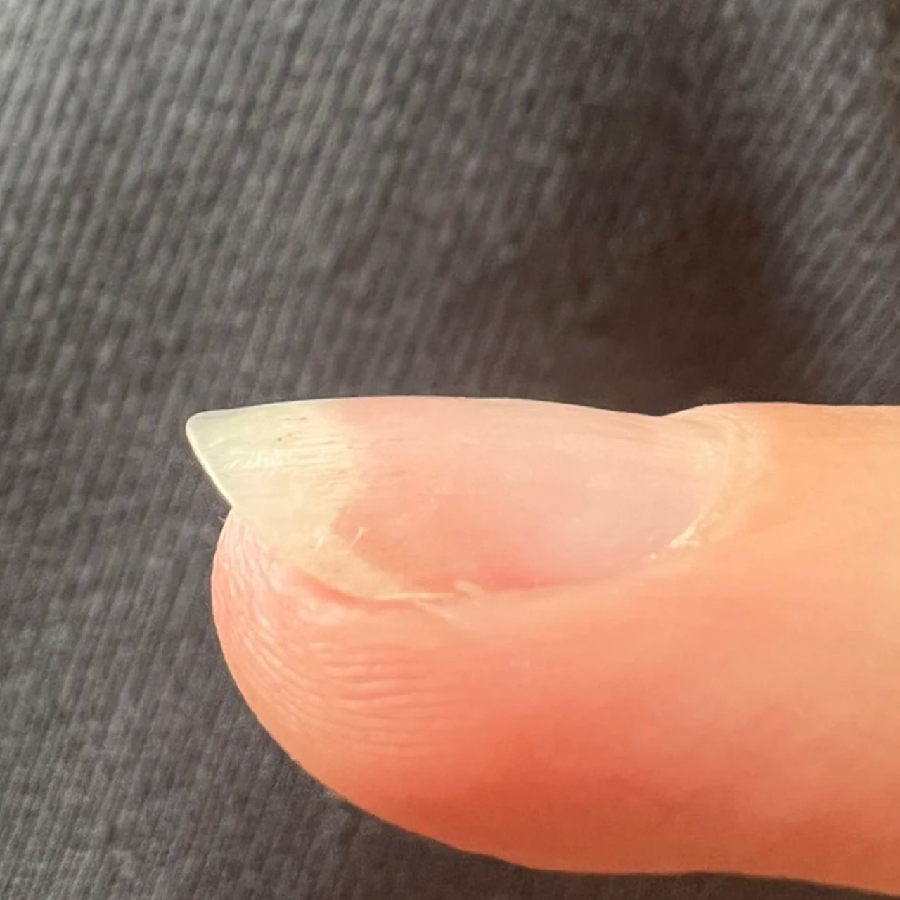 很多人做胶,贴甲片,指甲油卸甲,甚至养甲后出现这样的问题,有可能