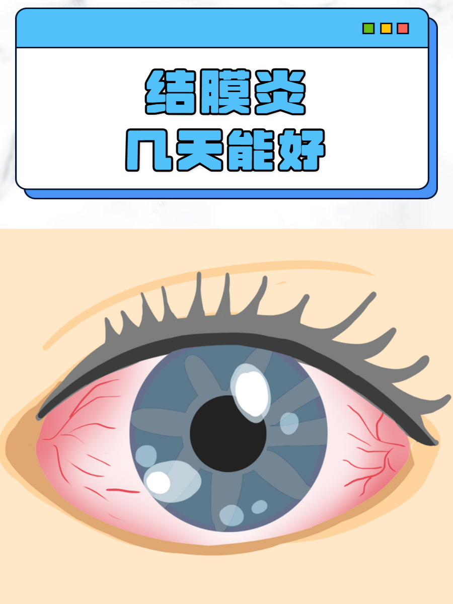 然而,结膜炎的恢复时间并非一成不变的,它受多种因素影响,本文将为您