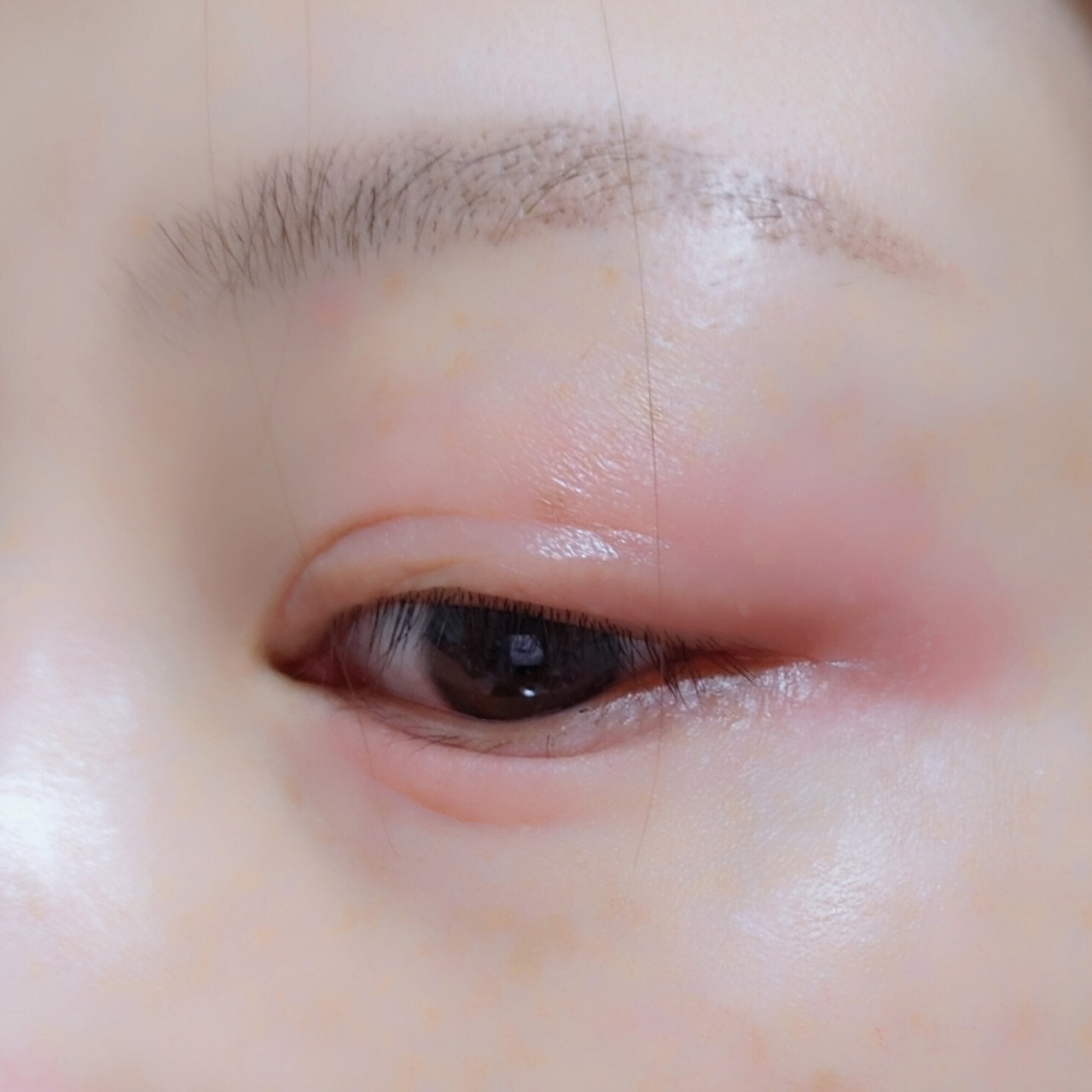 眼皮过敏,又红又肿还痒 也不知道怎么了,以前从来不过敏,什么化妆品都