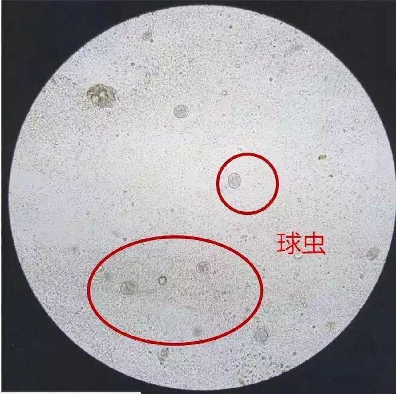 并没有针对驱球虫的,都是主要针对蛔虫,绦虫等狗狗常见寄生虫的,如果