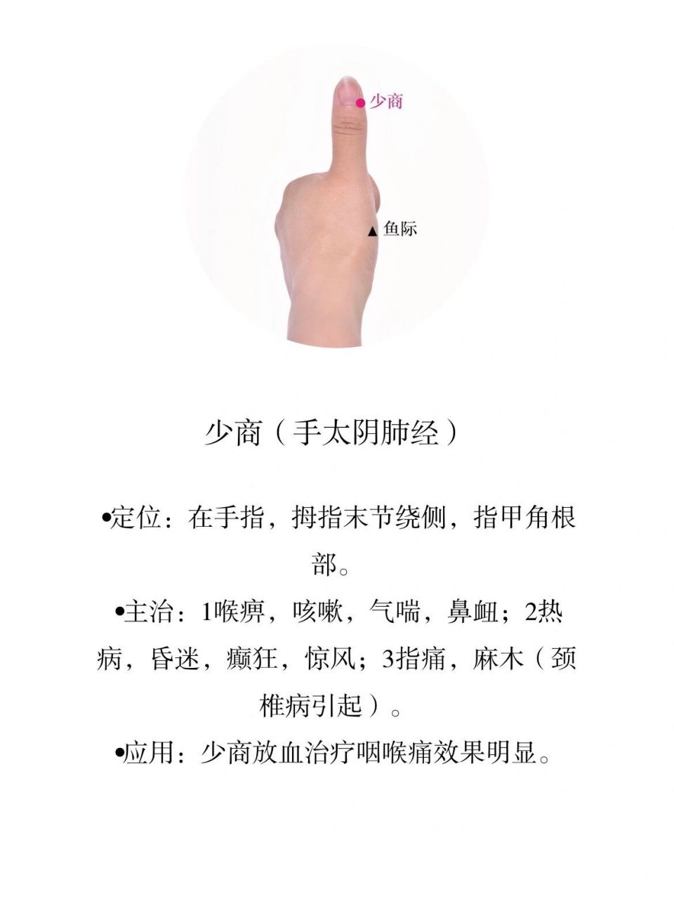 今日穴位——少商(手太阴肺经) 《铜人腧穴针灸图经