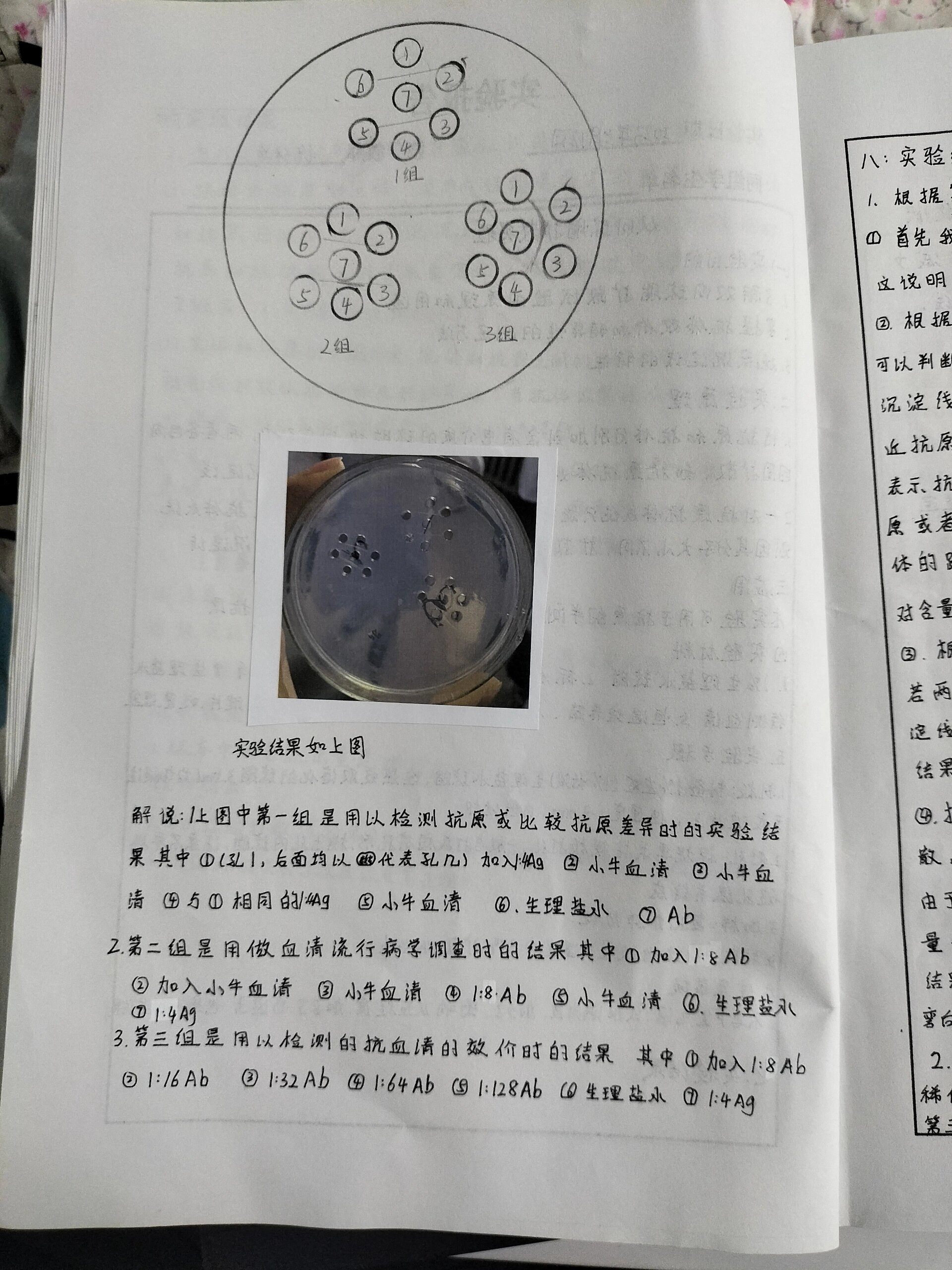 双向琼脂扩散试验图片