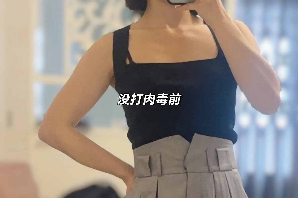 肌肉手臂打肉毒,第四天 今天效果跟昨天没有太大区别,手臂感受就是.