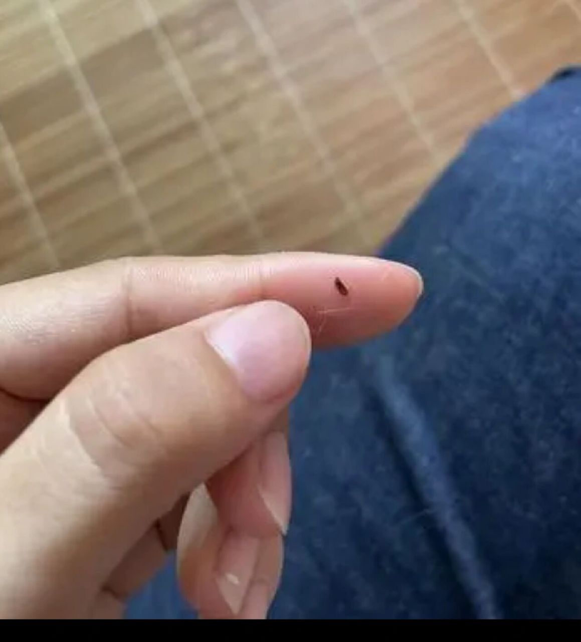 厦门灭跳蚤 怎么让你家里跳蚤灭绝干干净净 跳蚤属于蚤目的完全变态类