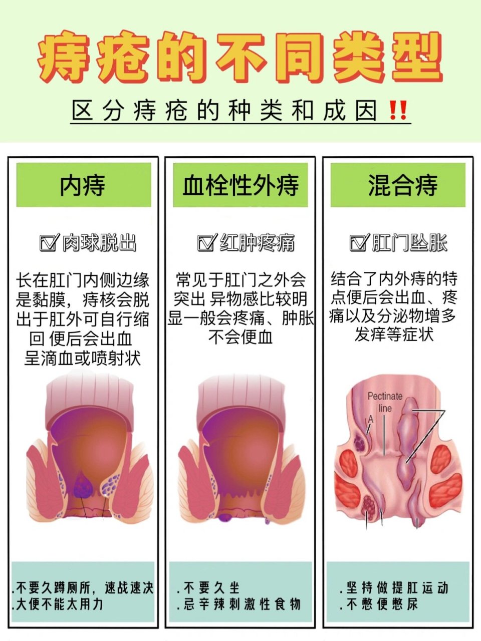 女生痔疮照放疗图片