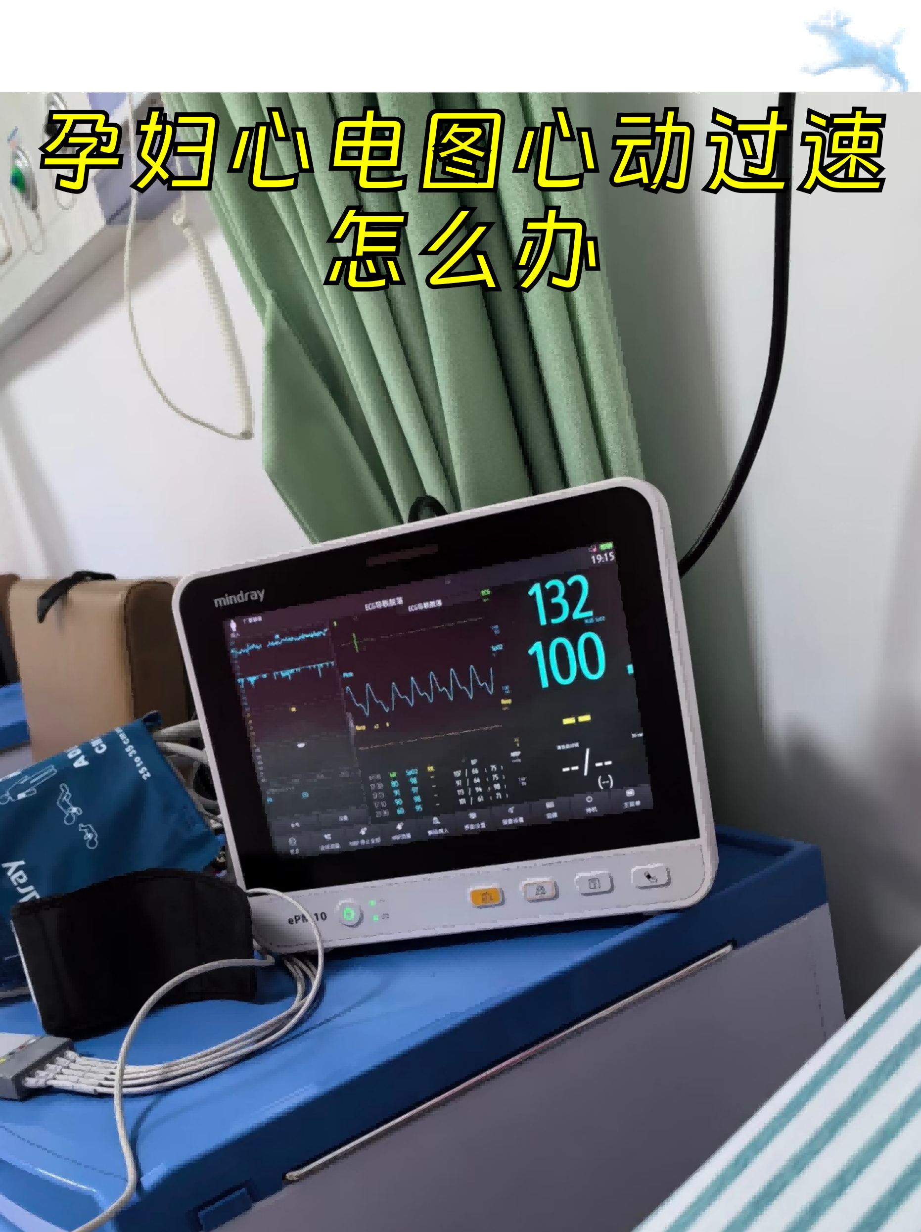包含北京大学首钢医院代问诊加陪诊挂号孕期健康咨询提醒,安心度过孕期的词条 包含北京大学首钢医院代问诊加陪诊挂号孕期健康咨询提醒,安心度过孕期的词条