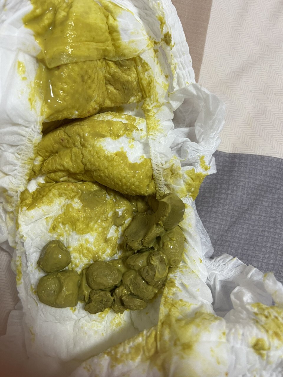 转完了之后没吃辅食,一天1000毫升奶,两天一次大便.