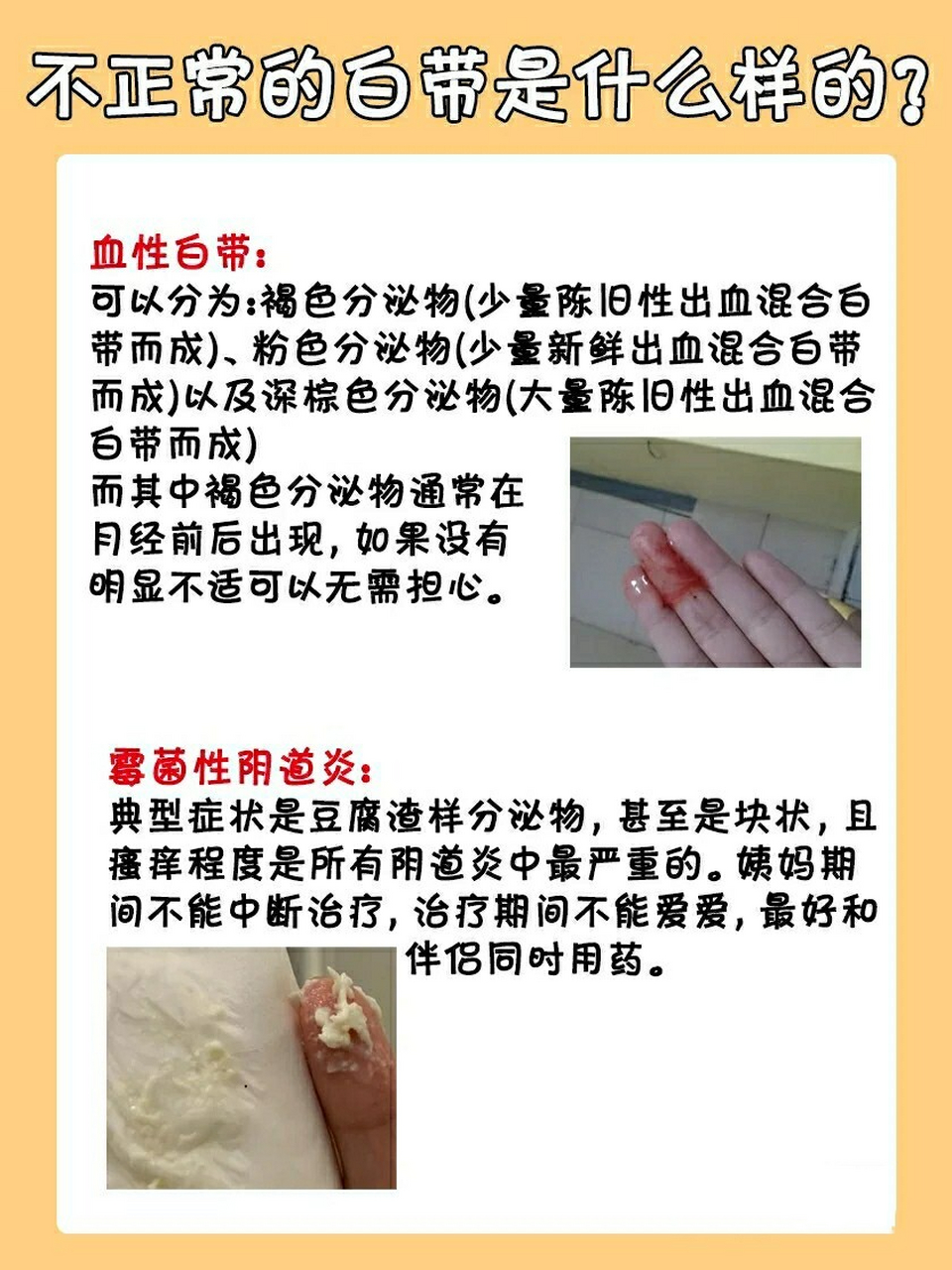 快来对比一下 你的白带什么样