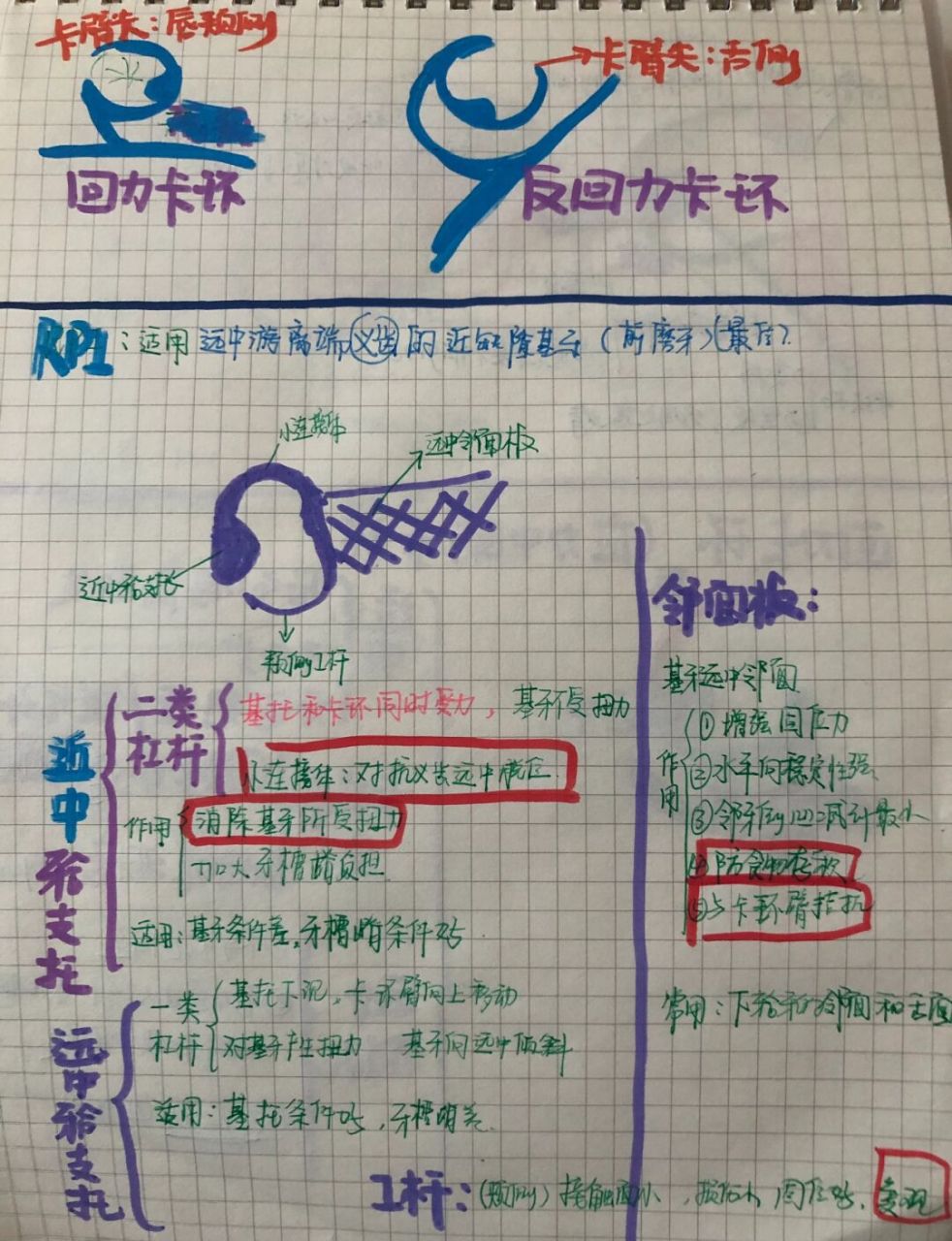 rpi卡环# #回力及返回力卡环