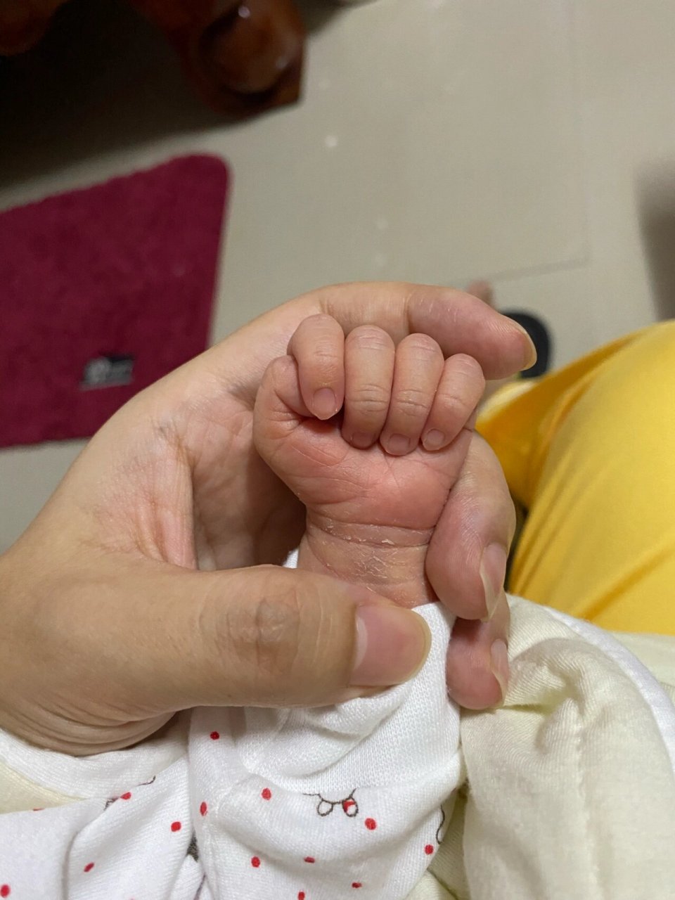 侧切伤口痊愈后又开始疼痛 9月5号顺产,因宝宝较大难产进行侧切,内部