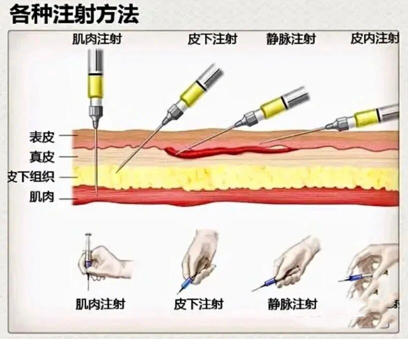 针头斜面向上的图片图片