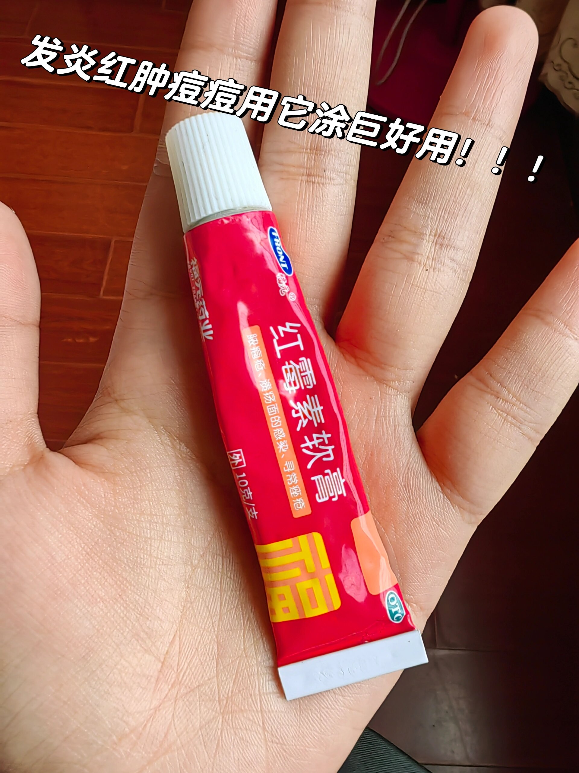 为什么痘痘都是红色的为什么在线