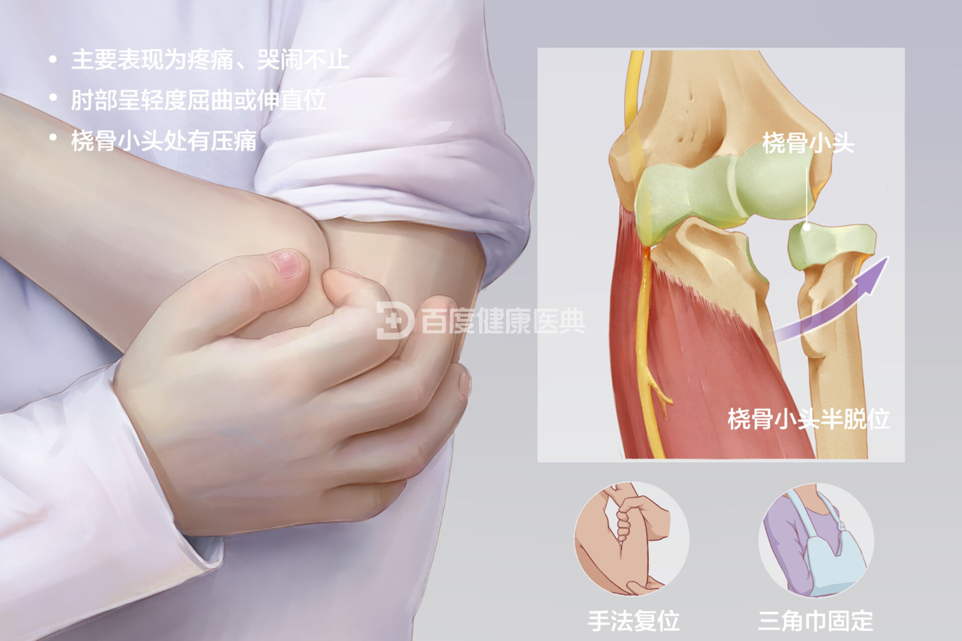 桡骨小头半图片