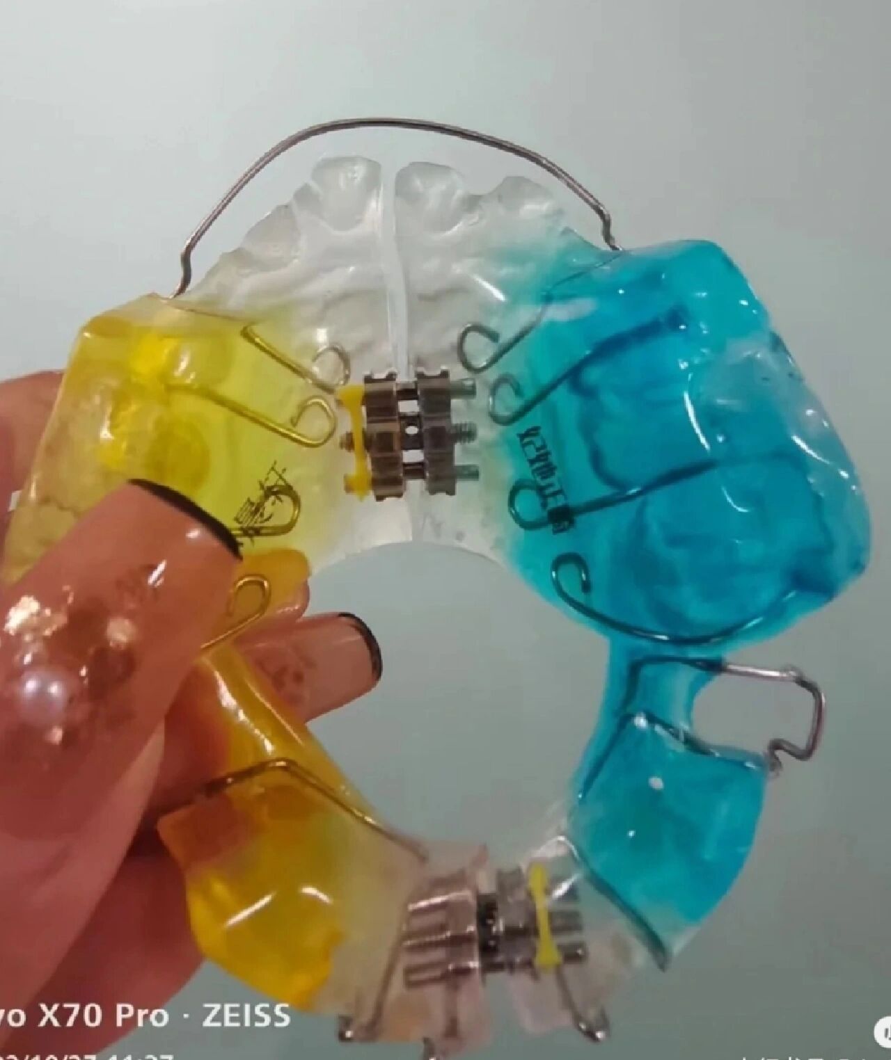 twin block功能性矫治器(tb) twin block功能性矫治器(tb),也叫双颌垫