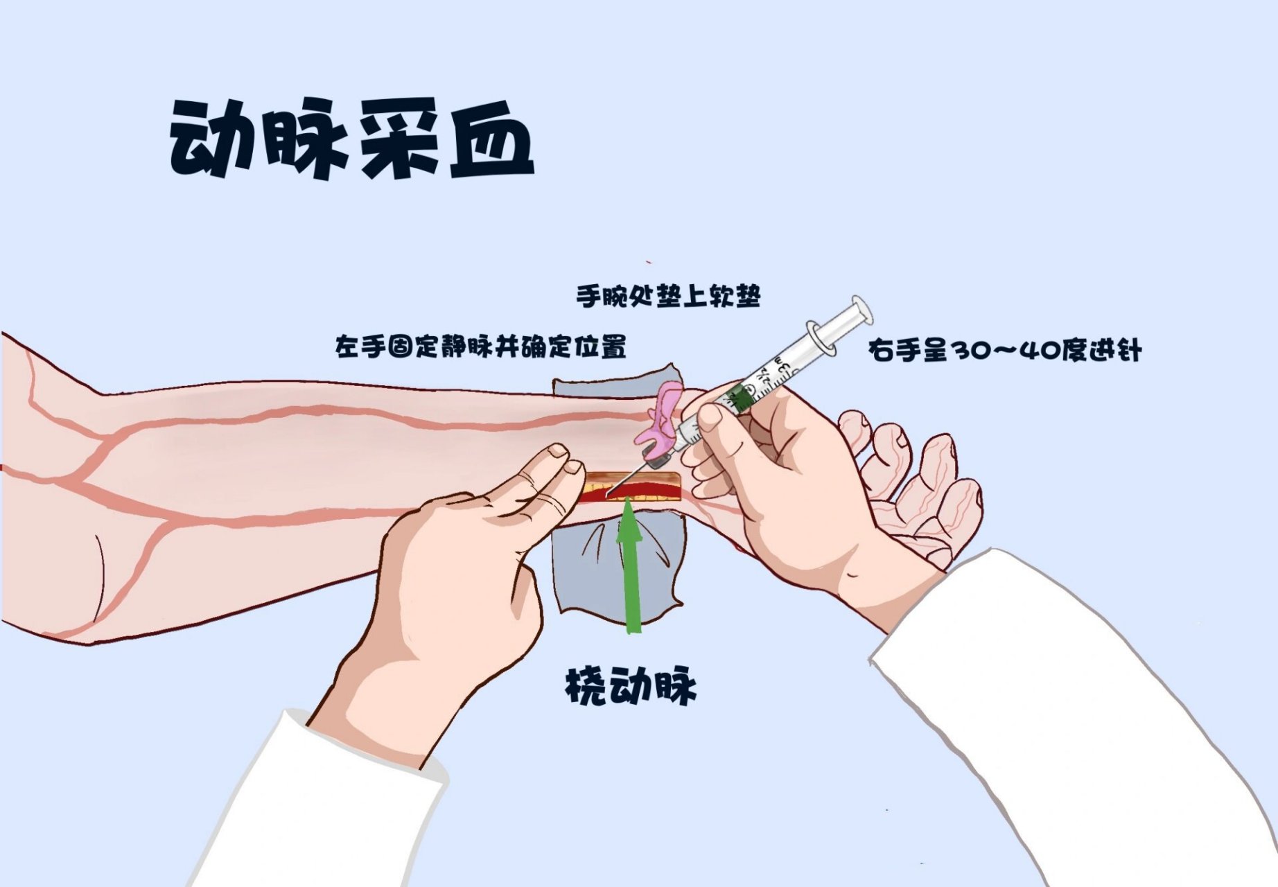 每日一画:护理专题之动脉采血