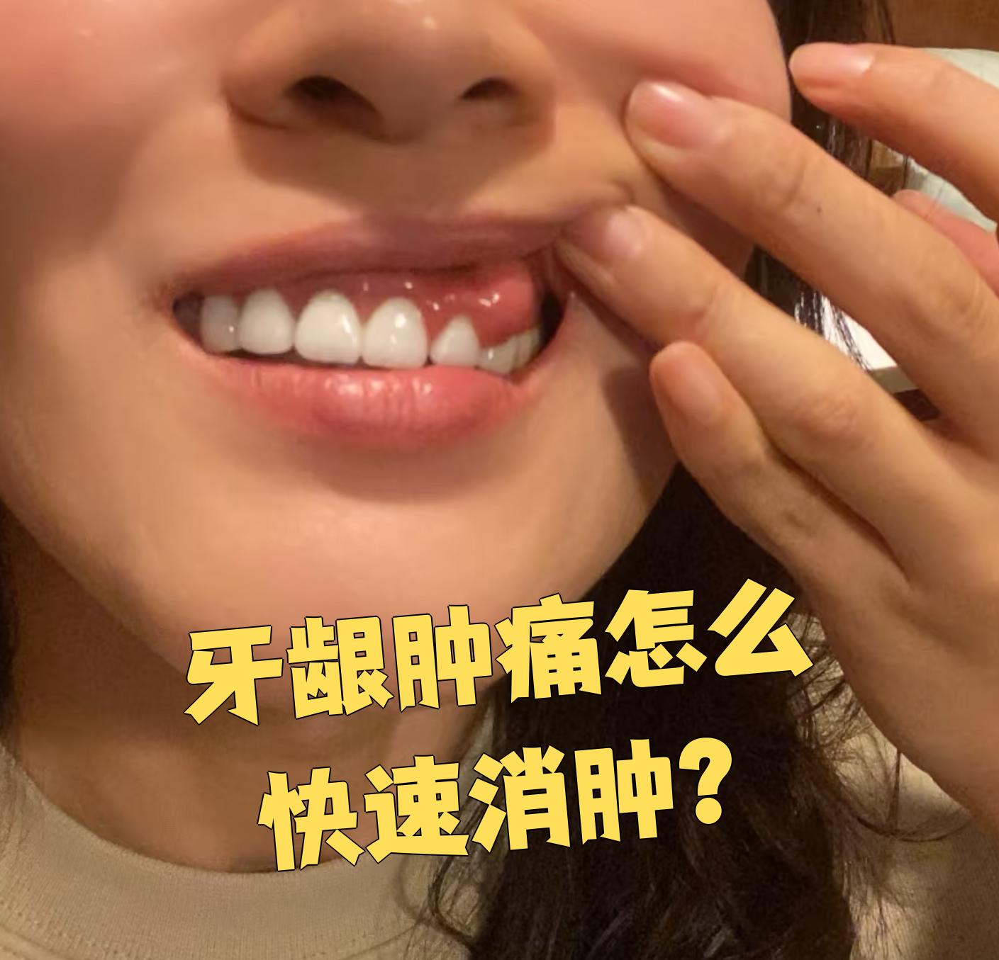 牙龈为什么会肿痛为什么在线