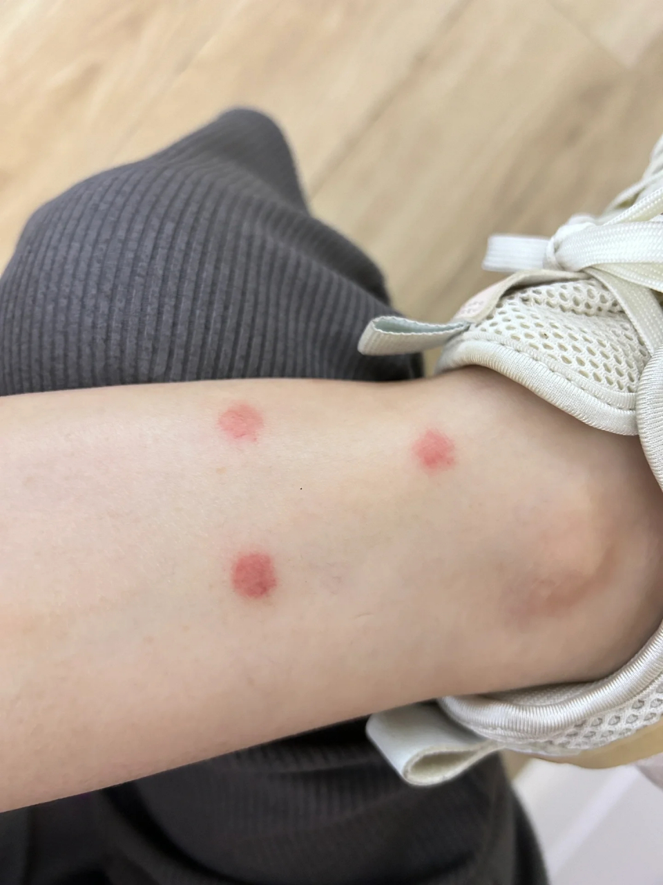 我丢你妈的蠓虫还是跳蚤01 第三天了怎么变得这么