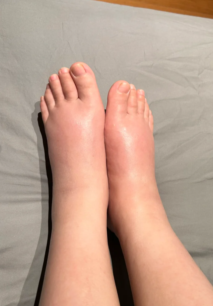 孕晚期容易出现妊娠期水肿,用热水泡脚可以促进血液循环,尤其是下肢