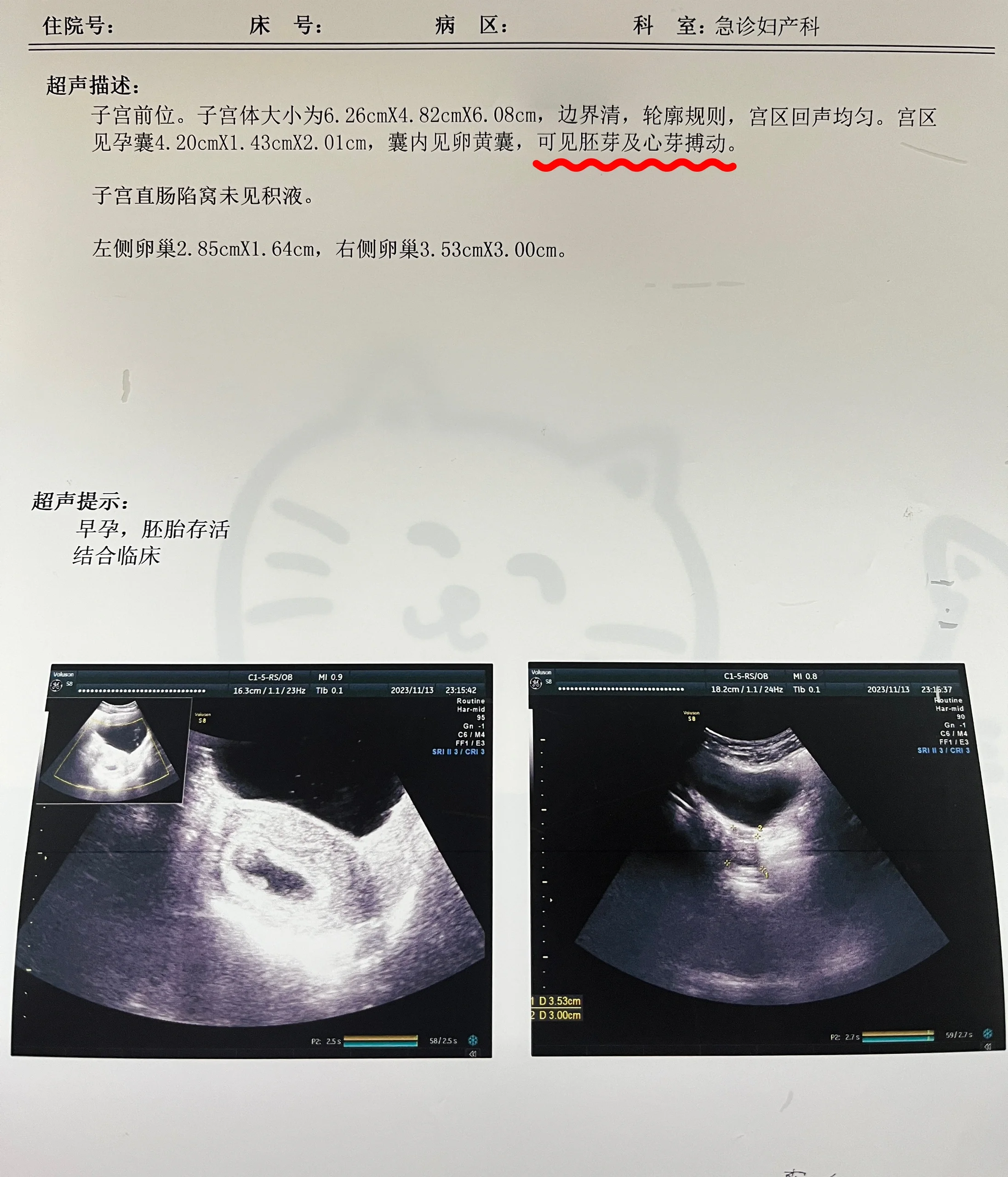 女性腹腔巨大囊性包块图片