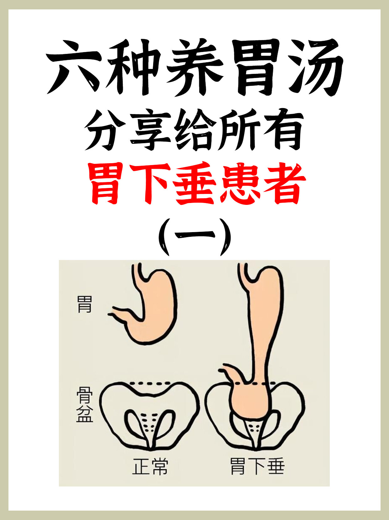 为什么胃下垂不用治疗百科在线 为什么胃下垂不用治疗百科在线