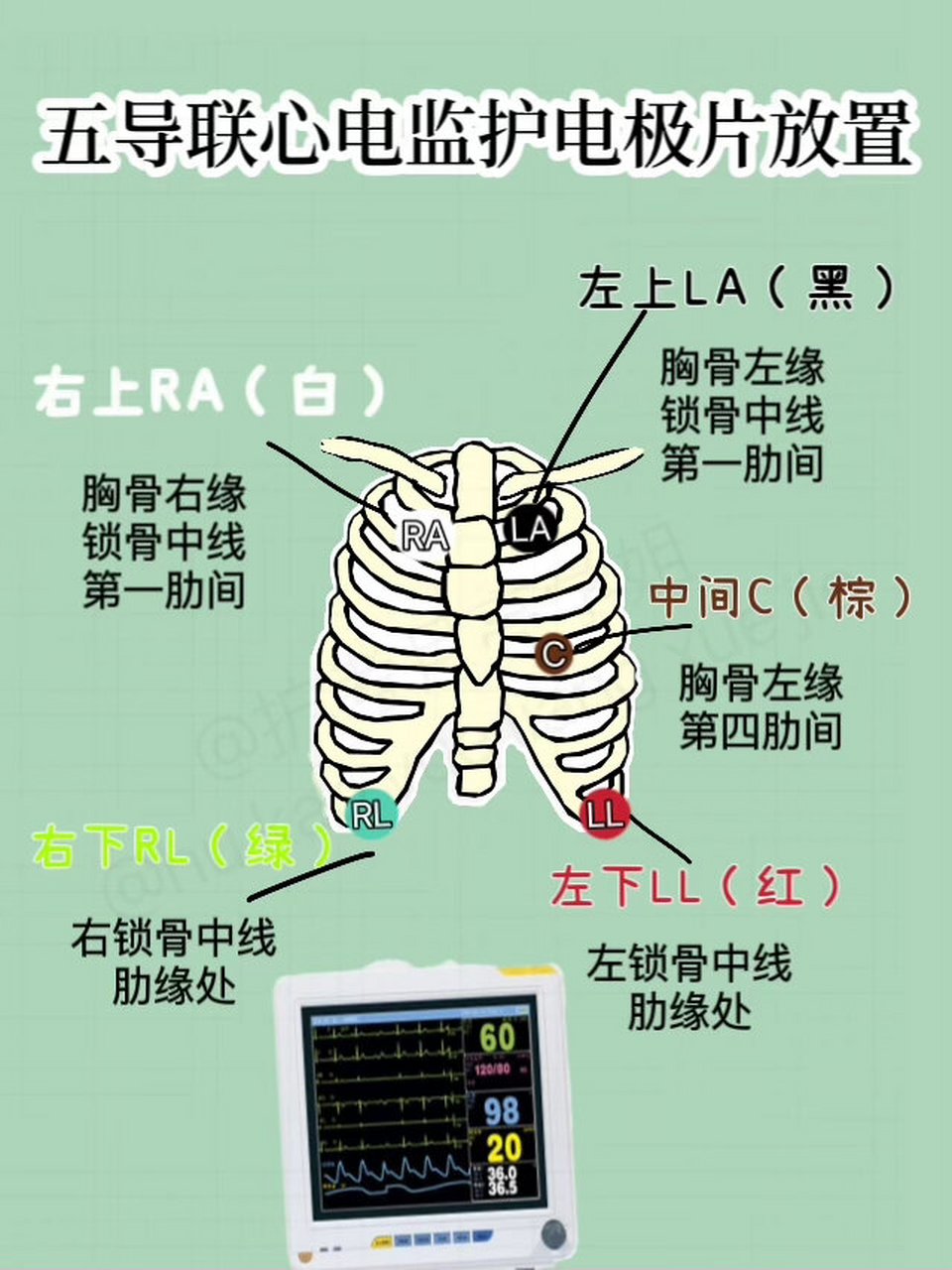 胸导联定位图片