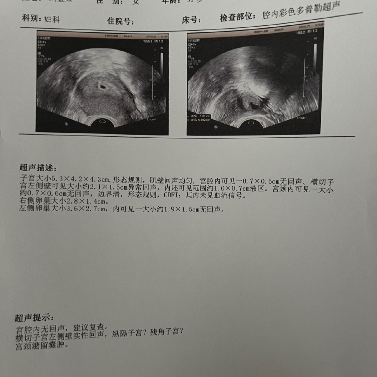 纵隔子宫怀孕太容易焦虑了 | 金金の怀孕日记