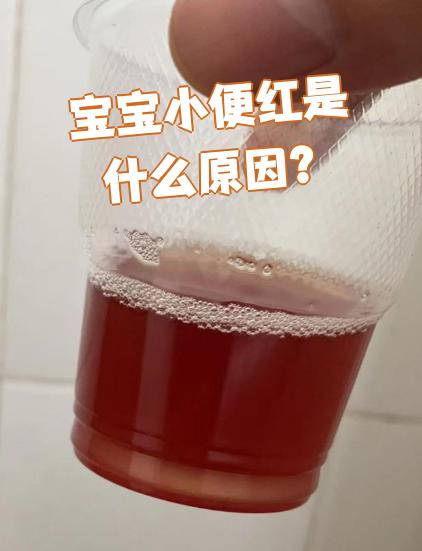 为什么尿出来的尿是红色的还有泡沫为什么在线