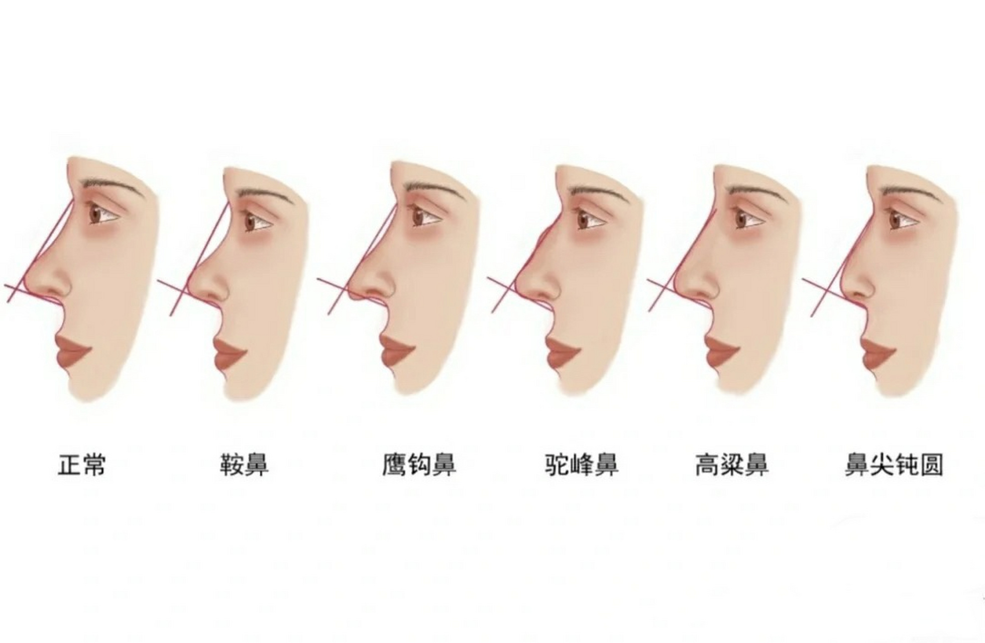 平时总是说各种鼻型,大家可能没有明确理解区别在哪里,这样是不是能一
